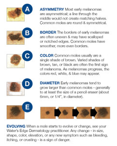 changing-moles - Fraser Medical Clinic